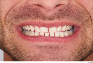 Garrott teeth 0001.jpg